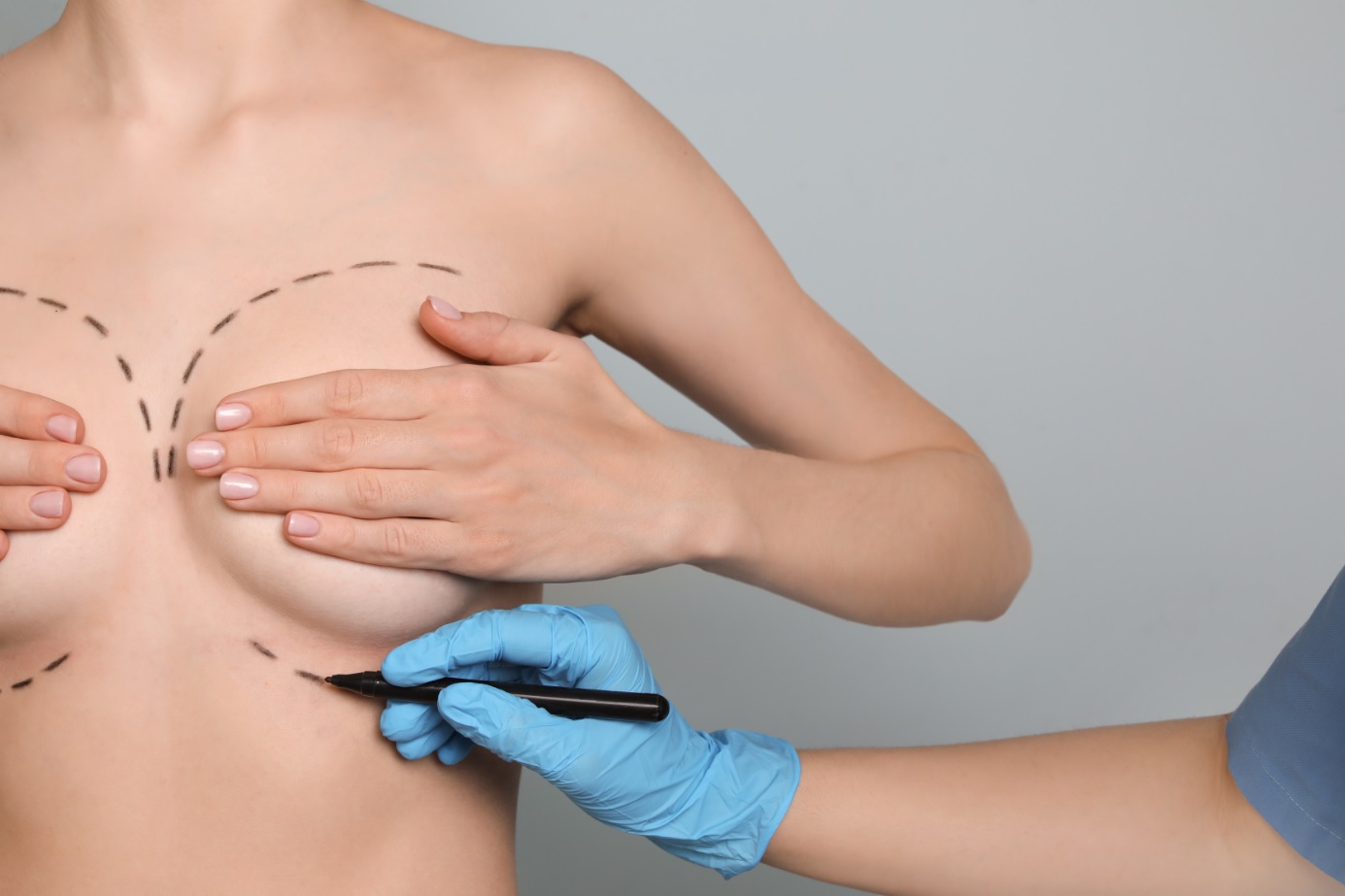Lire la suite à propos de l’article La chirurgie mammaire